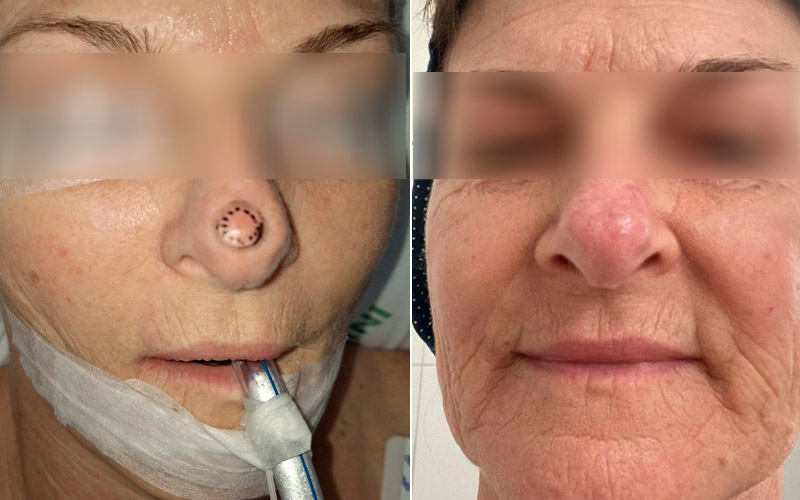 Resultado do tratamento &mdash; foto 01